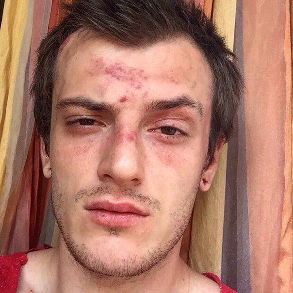Побили